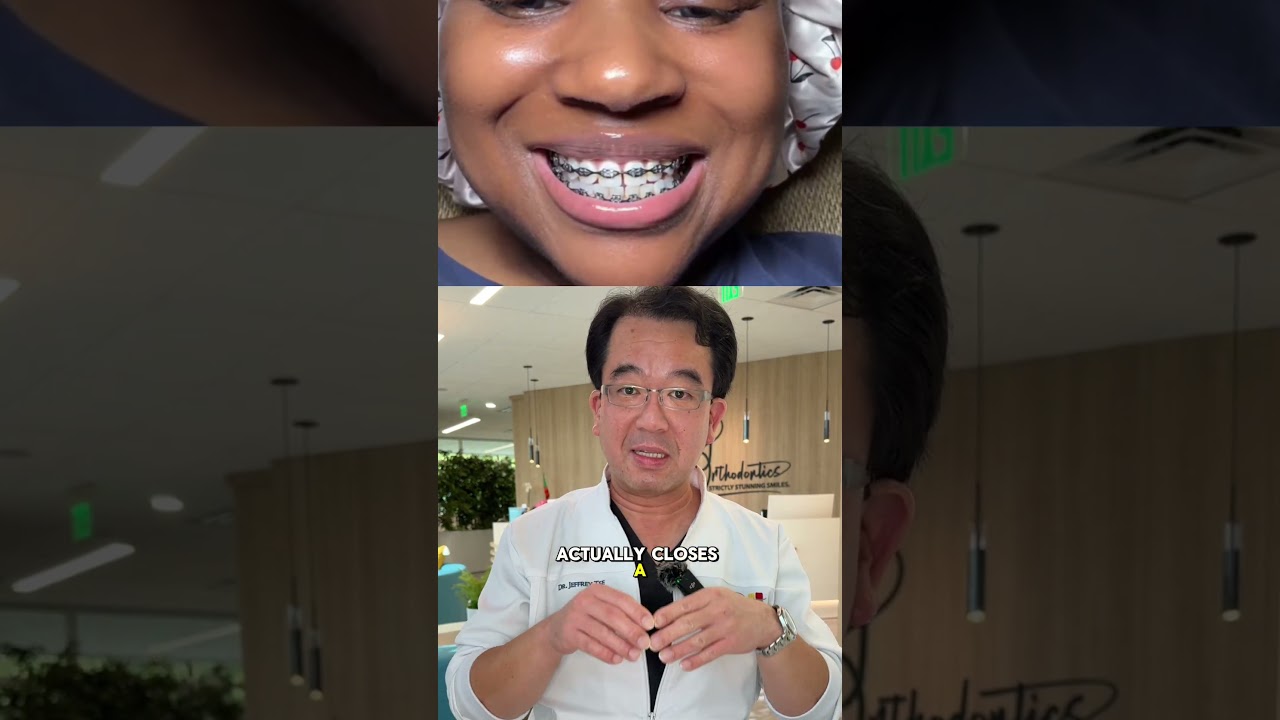 The power of Power Chains! 