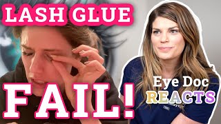 Cassandra Bankson Lash Fail | Eye Doctor Reacts