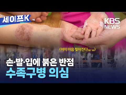 Highly Contagious! Prevention and Management of Hand, Foot, and Mouth Disease in Infants and Todd...