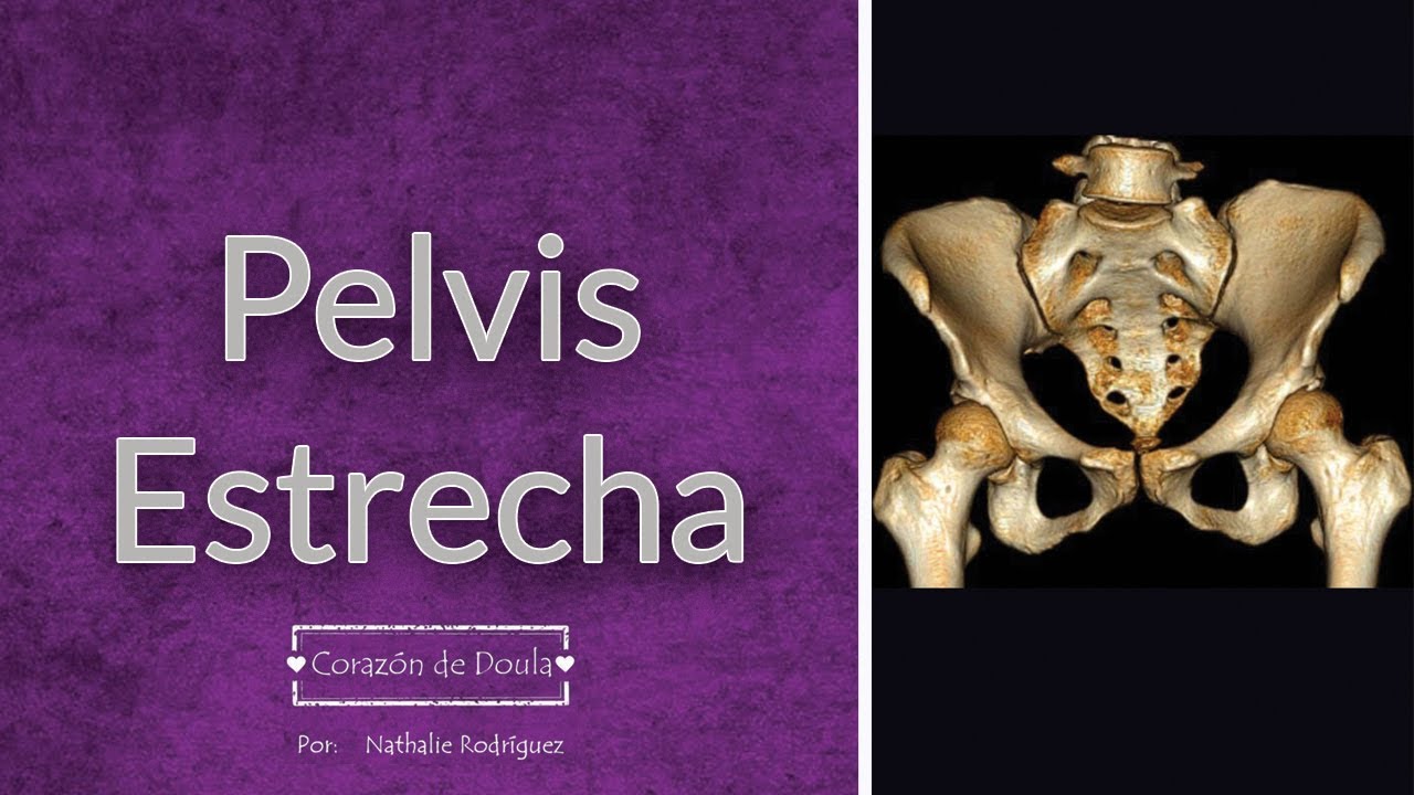 Como Saber Si Tengo La Pelvis Estrecha