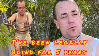 27 Blind And Homeless