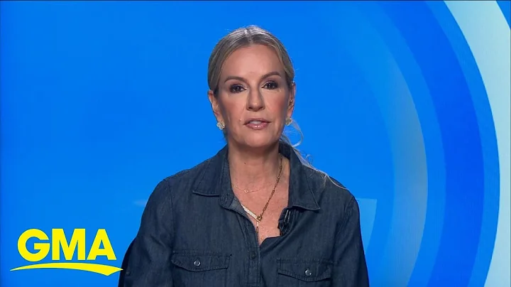 Tips to prevent varicose veins