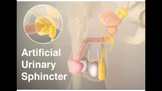 Artificial urinary sphincter (AUS)