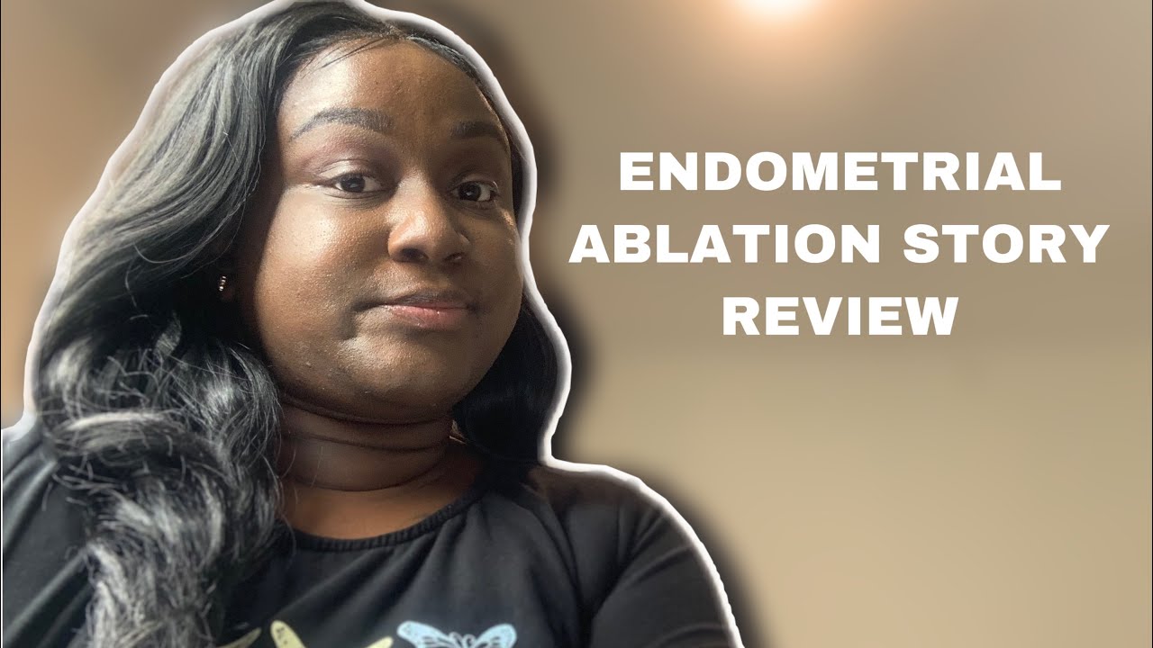 MY ENDOMETRIAL ABLATION STORY REVIEW DOES IT WORK? 3 MONTHS POST OP YouTube