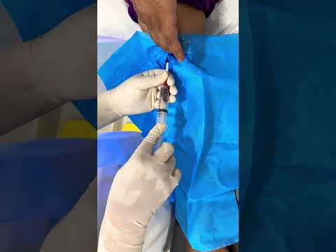 Withdraw Blood culture