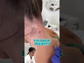 【液体窒素で出来物治療】処置のやり方にたかし先生がドン引き!病院選びは細心の注意を!