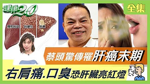 蔡頭驚傳罹肝癌末期！右肩痛.口臭恐怕你的肝遭殃了？張洪量妻活體換肝重生！肝衰竭危及性命 觀察2紅1黃！健康2.0 20220102 (完整版) - 天天要聞