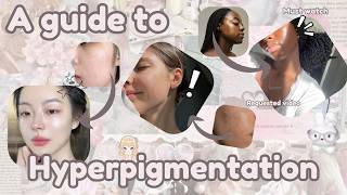 HOW TO FIX UNEVEN SKIN TONE AND HYPERPIGMENTATION (for beginners)#glowup #hyperpigmentation