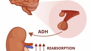 علاج كثرة التبول الناتجه عن نقص هرمون ADH screenshot 5