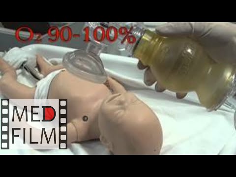 Реанимация новорожденных в родильном зале © Neonatal resuscitation
