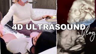 4D Ultrasound At 32 Weeks