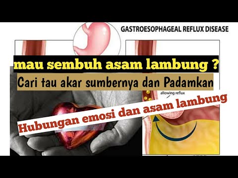 Studi Penggunaan Obat Asam Lambung Gerd Jangka Panjang Bisa Studi Penggunaan Obat Asam Lambung Gerd Jangka Panjang Bisa