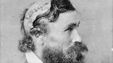 The Man Who Survived Being Scalped | Robert McGee