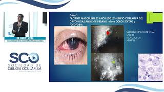 Enfoque Diagnóstico y Terapéutico en el Manejo de Ulceras Corneales - Sociedad de Cirugía Ocular S.A