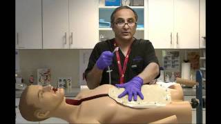Non-balloon replacement PEG: setup and placement video