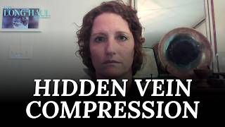 Doctors Missed the Vein Compression Behind My Symptoms