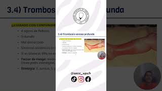 EDEMA | #medicina #enam #tips #shorts #fyp #semiologia #secc_upch
