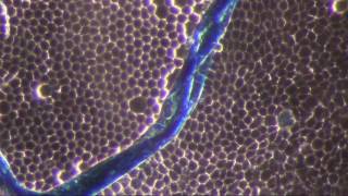 Is this a thallus
