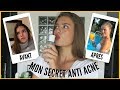 COMMENT J'AI VAINCU  L'ACNÉ - Skincare routine