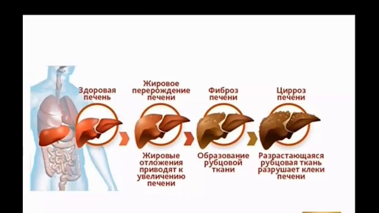 Сколько восстанавливается печень после отказа. Печень регенерируется. Печень может регенерировать. Восстановление клеток печени.