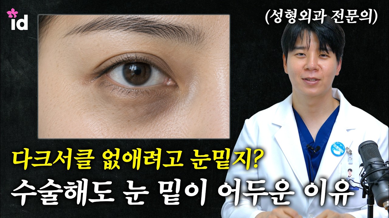 다크서클 ❕ 싹 없애 드립니다