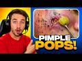 Reacting to Extreme CYST & Pimple Popping Videos (SO SATISFYING)