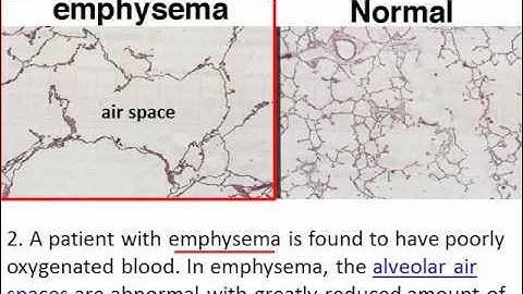 Diffusion & Osmosis   Problem 2