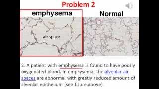 Diffusion & Osmosis   Problem 2