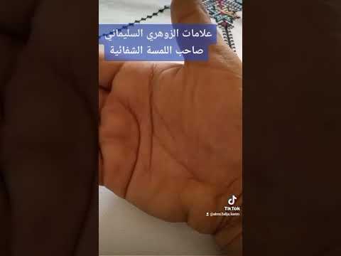 صاحب اللمسة الشفائية الزوهري السليماني صاحب الكف    القدرة الخارقة