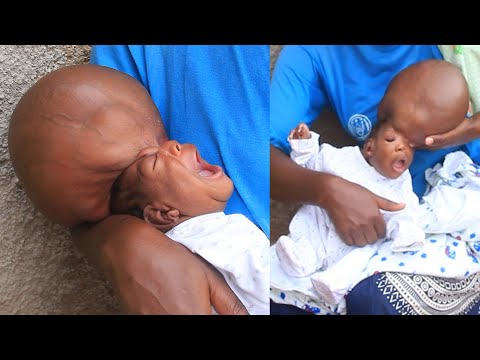 Watching OUR BABY take his last breath : THIS VIDEO WILL MAKE YOU CRY