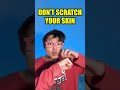 😱 WHAT HAPPENS TO PIMPLES? Oops… Don’t POP Them! #shorts #kids