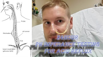 24hr PH Impedance Probe Testing for Acid Reflux and GERD Symptoms