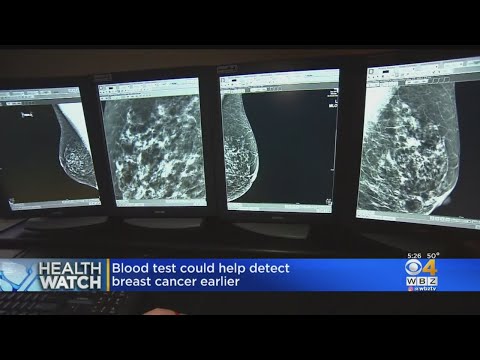 HealthWatch: Blood Test Could Help Detect Breast Cancer