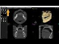 Cs 3d imaging software basic tutorial carestream