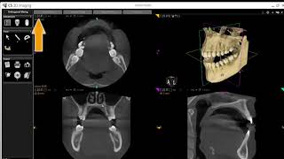 CS 3D imaging software basic tutorial #Carestream screenshot 3