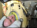 Surviving with an Iron Lung