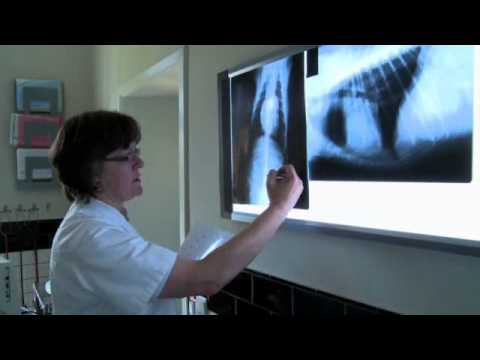 Radiografia toracica: parametri nella norma (3/3)  Strutture normali