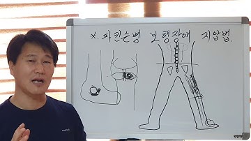 파킨슨병 보행장애 즉시 잘걸어지는 힘줄인대 지압법 입니다. (133번째 동영상 입니다.)