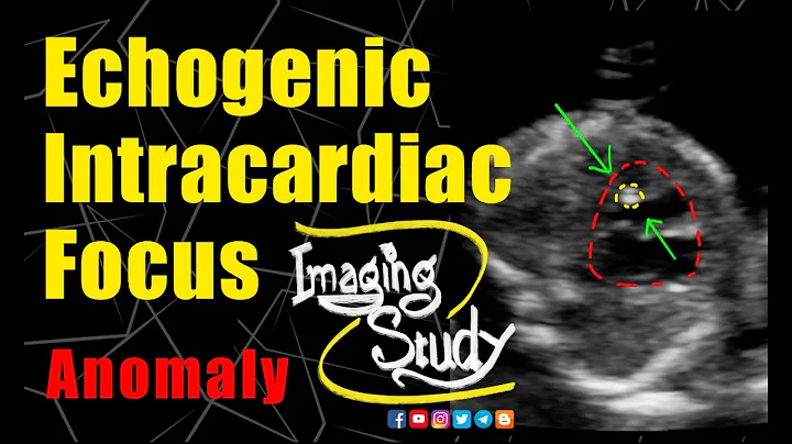 Focus échogène intracardiaque fœtal : que signifie-t-il ?