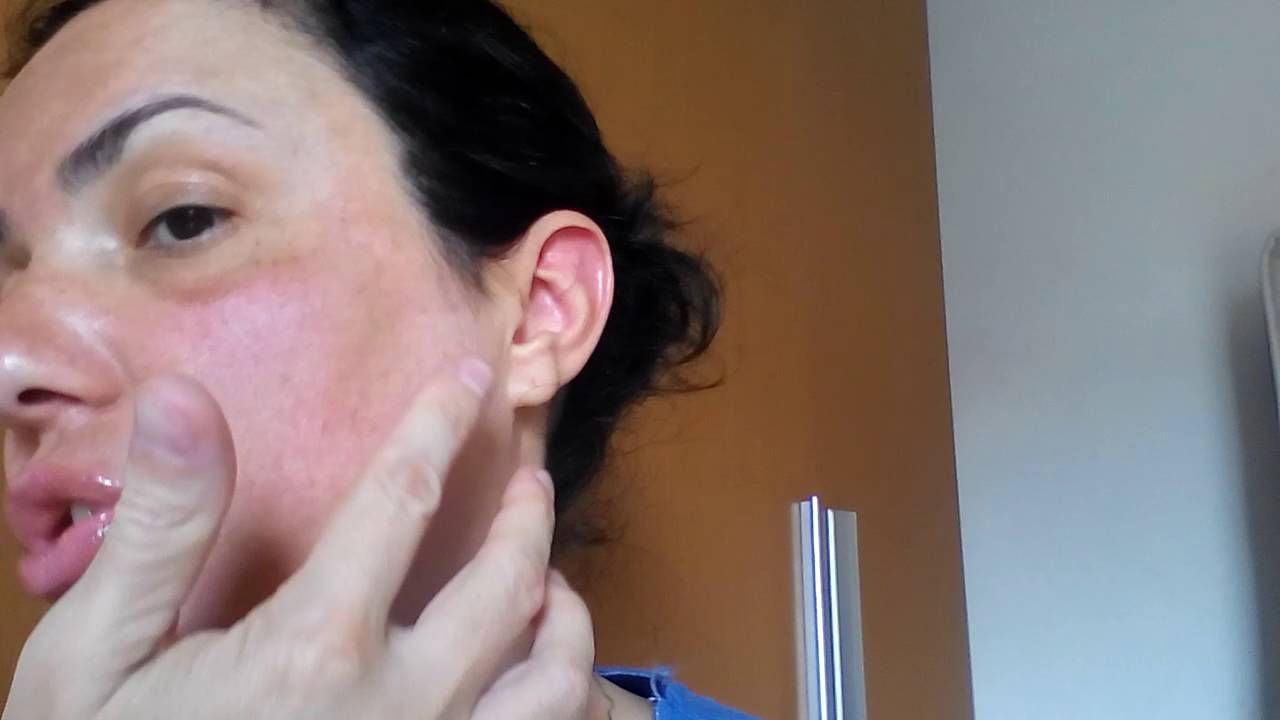 Dia 3 de uso do ácido Suavicid . YouTube