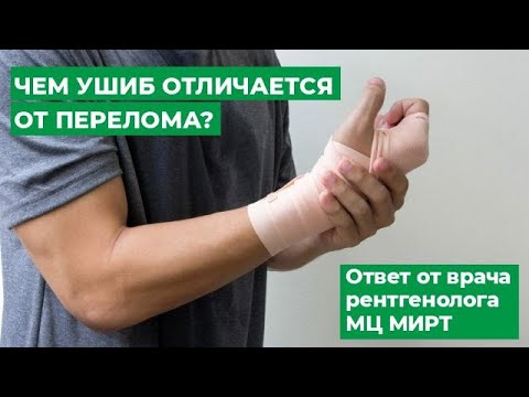 Чем ушиб отличается от перелома? Ответ от врача рентгенолога МЦ МИРТ