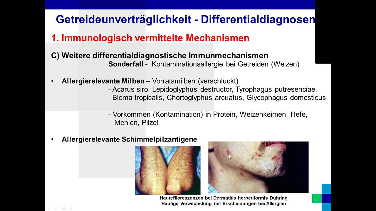 Nahrungsmittelunverträglichkeit heilen - geht das? Antworten in der Mikrobiom Praxis Online