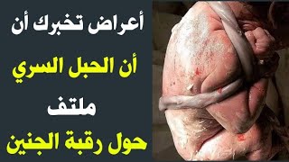 أعراض تخبرك أن الحبل السري ملتف حول رقبة الجنين وهل التقلب أثناء النوم هو السبب في ذلك ؟