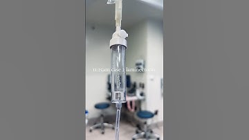 Anesthesiologist Assistant: 16 hour shift #anesthesia #anesthesiology #premed