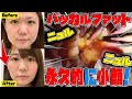 【整形】ニュルニュル出す！バッカルファット除去で永久的に小顔に！美容外科医が徹底解説！/Buccal fat pad removal