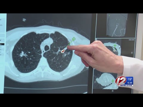 Video: Lungcancer: Typer, överlevnad Priser Och Mer