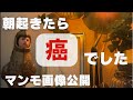 【衝撃】ガン告知までの一部始終