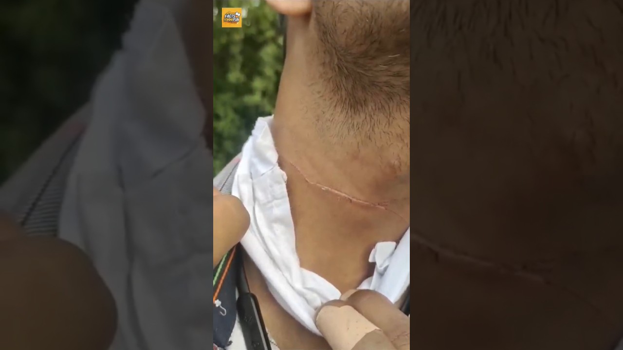 Kite Flying Danger! How Chinese Manjha Puts You at Risk