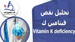 تحليل نقص فيتامين ك: كيفية الكشف عنه |vitamin K deficiency