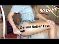 Can a .5mm Derma Roller get rid of CELLULITE & forehead wrinkles?